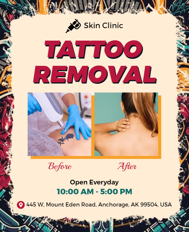 before and after tattoo removal flyer