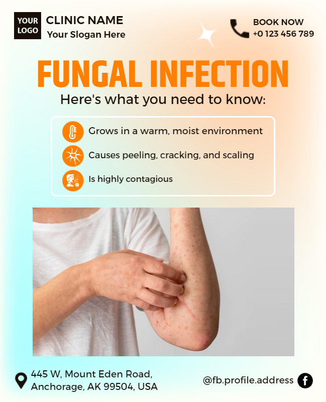 Fungal Infection Health Promotion Flyer